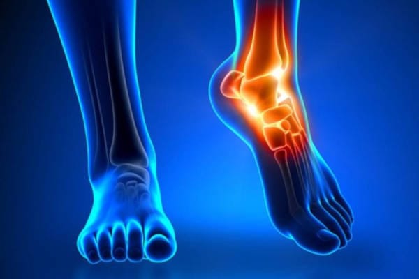 Контрактура голеностопного сустава: причины, симптомы и современные подходы к лечению